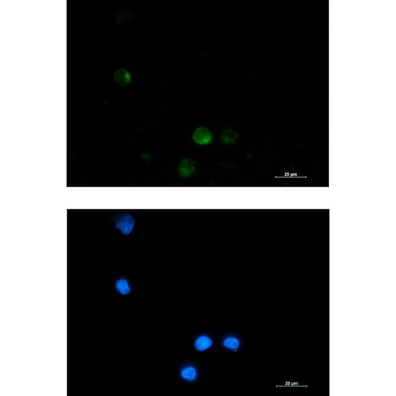 SSX2IP Rabbit mAb