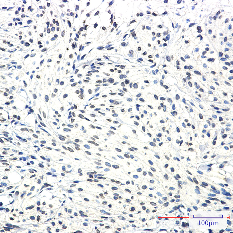 SSX2IP Rabbit mAb