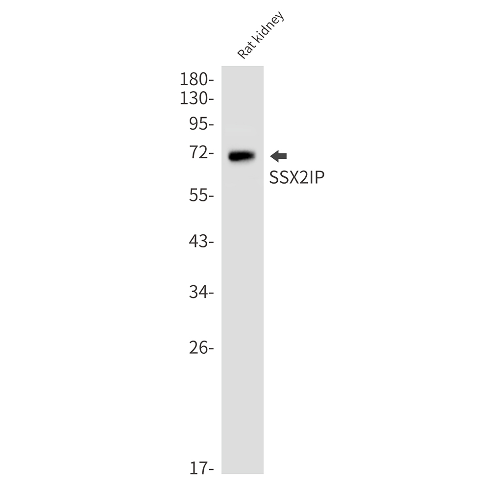 SSX2IP Rabbit mAb