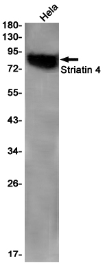 Striatin 4 Rabbit mAb