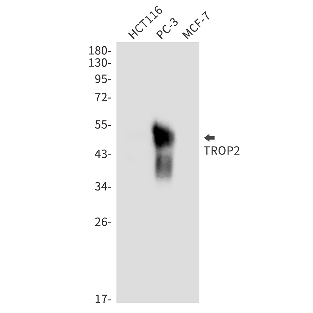 TACSTD2 Rabbit mAb