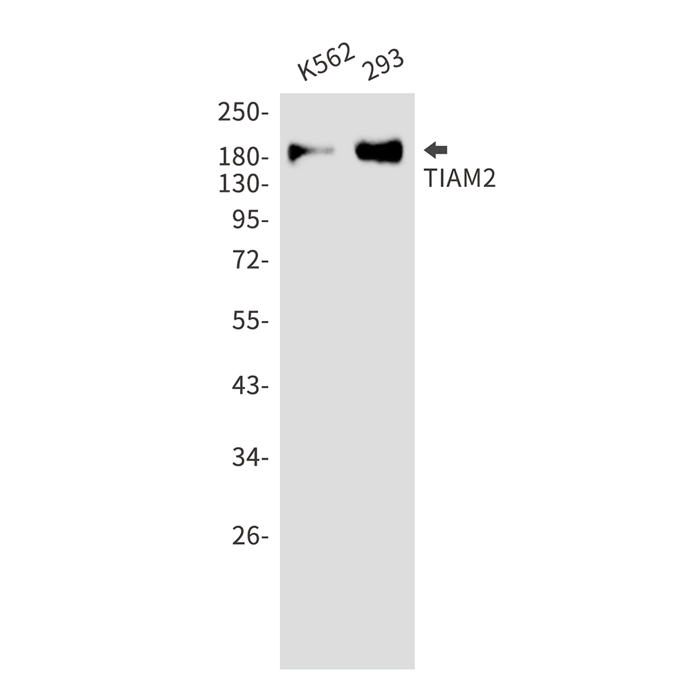 TIAM2 Rabbit mAb