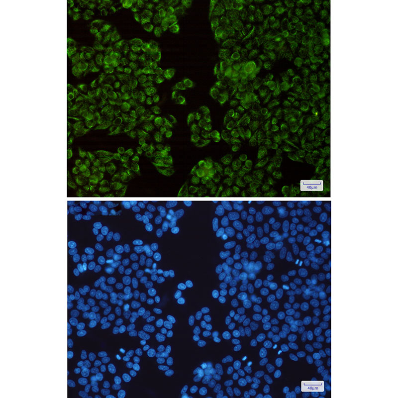 TIMM44 Rabbit mAb