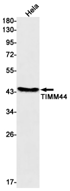 TIMM44 Rabbit mAb