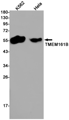 Transmembrane Protein 161B Rabbit mAb