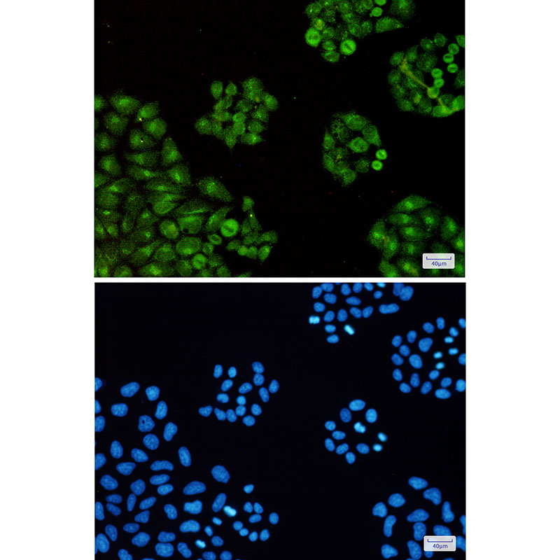 Transcription Termination Factor 2 Rabbit mAb