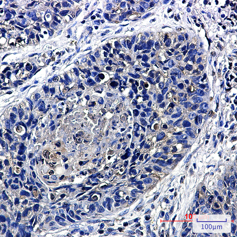 Transcription Termination Factor 2 Rabbit mAb