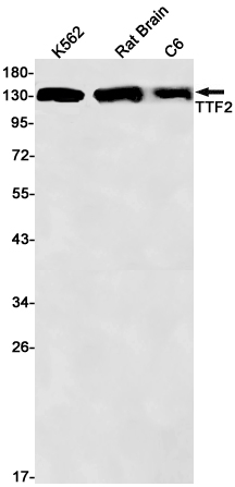 Transcription Termination Factor 2 Rabbit mAb