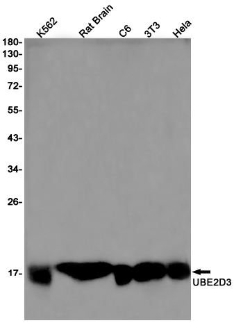 Ubiquitin Conjugating Enzyme E2 D3 Rabbit mAb