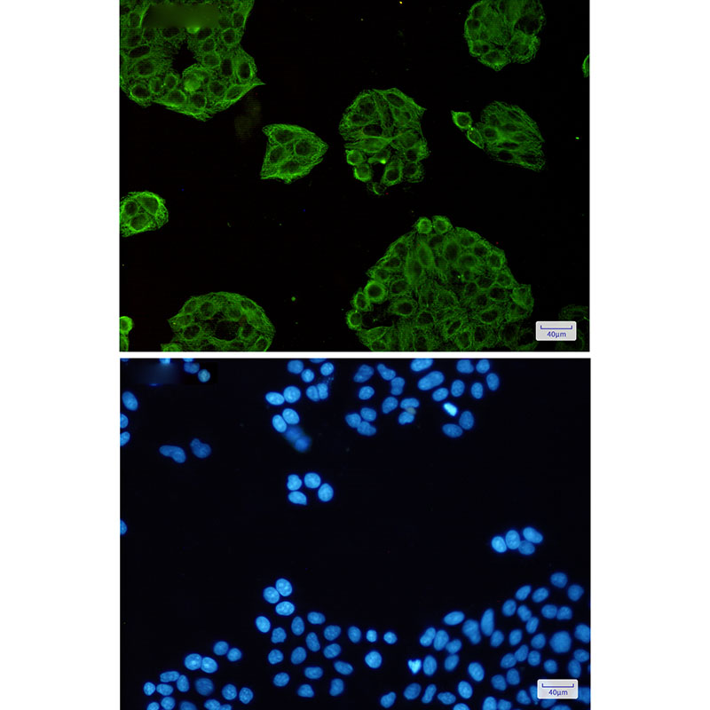 VPS4A Rabbit mAb