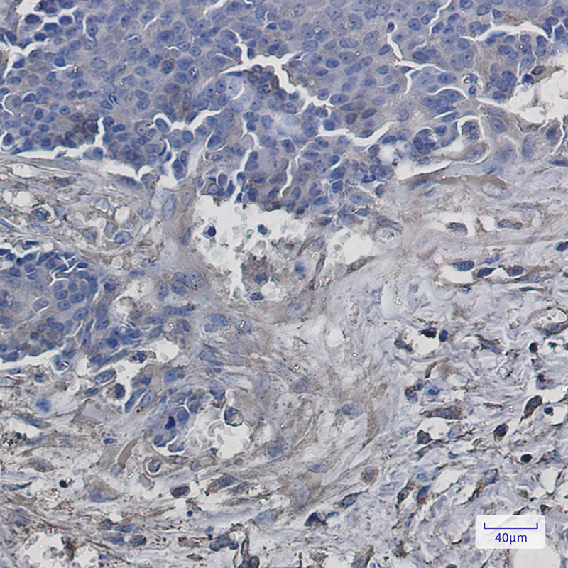 VPS4A Rabbit mAb