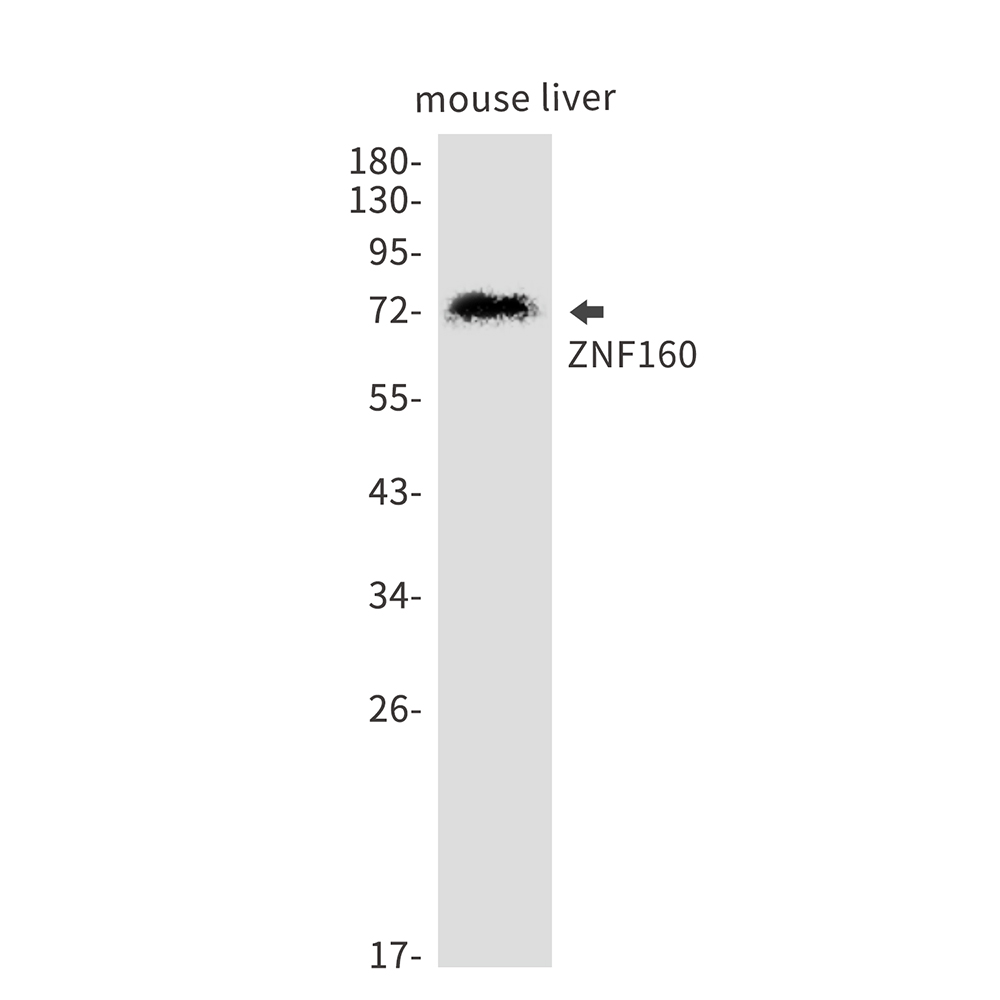 ZNF160 Rabbit mAb