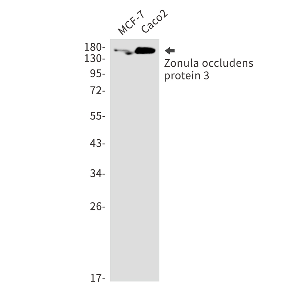 Tight Junction Protein ZO 3 Rabbit mAb