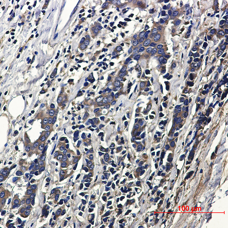 ACTR1B Rabbit mAb