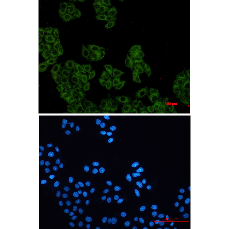 Actin Related Protein 2 Rabbit mAb