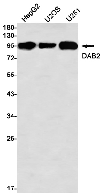 DAB2 Rabbit mAb