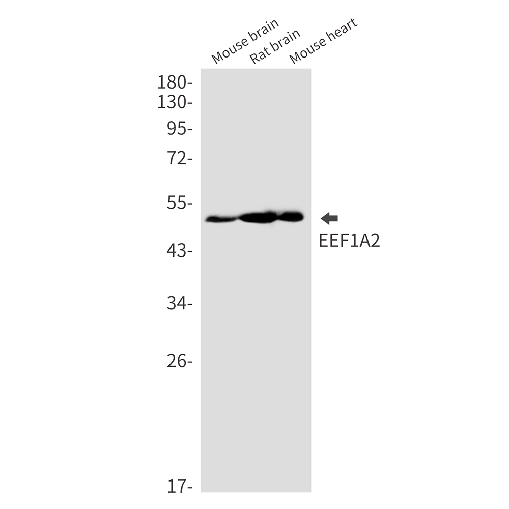 Elongation Factor 1A2 Rabbit mAb