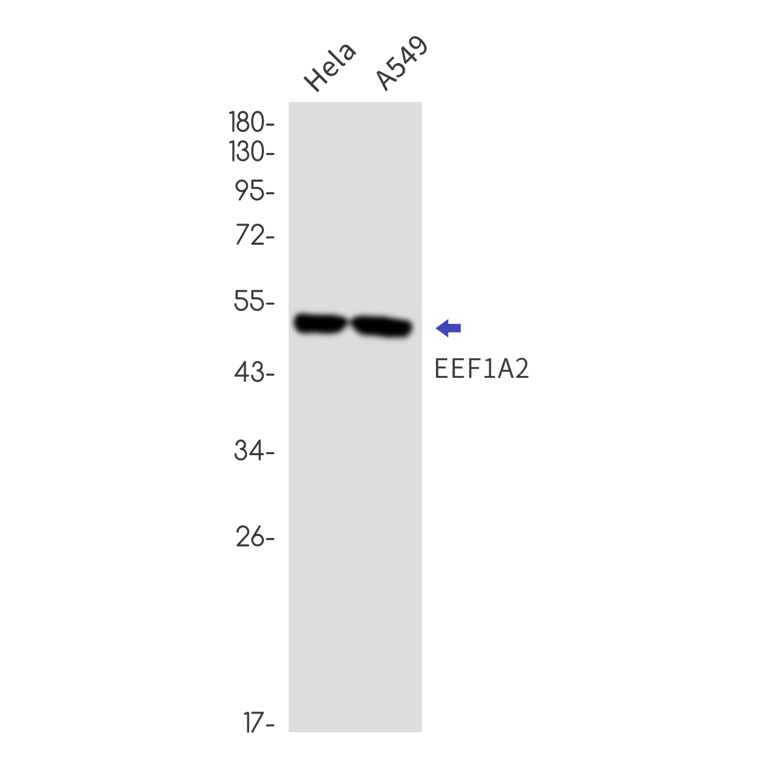 Elongation Factor 1A2 Rabbit mAb