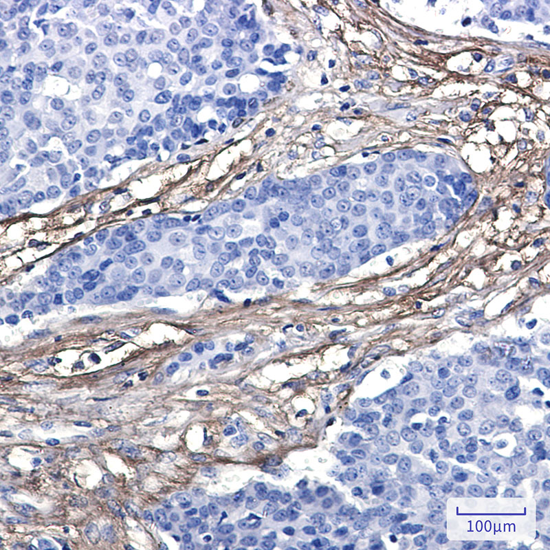 EFEMP1 Rabbit mAb