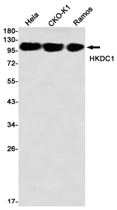 HKDC1 Rabbit mAb