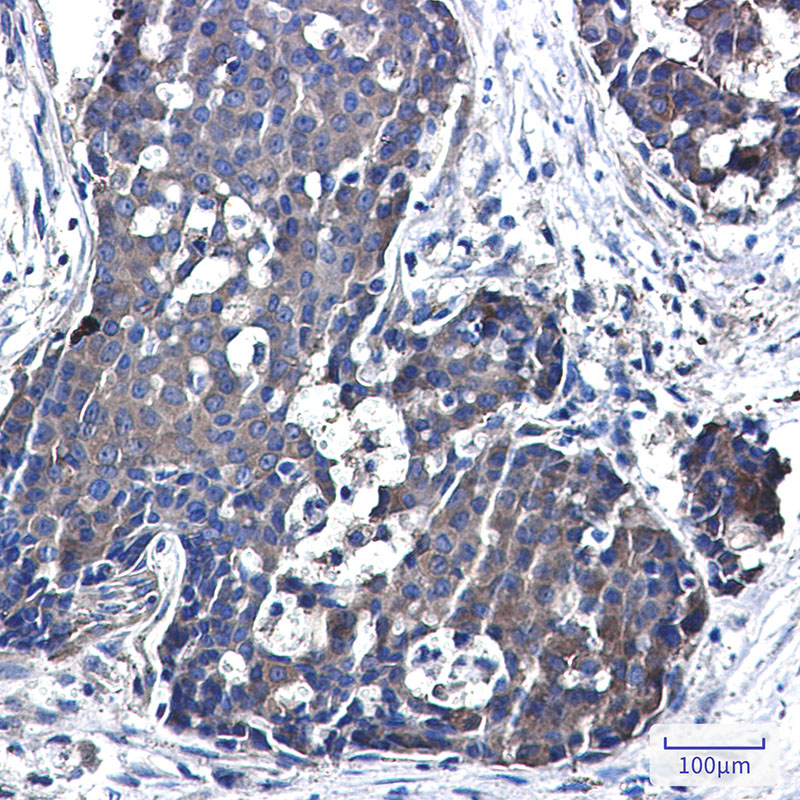 NME3 Rabbit mAb