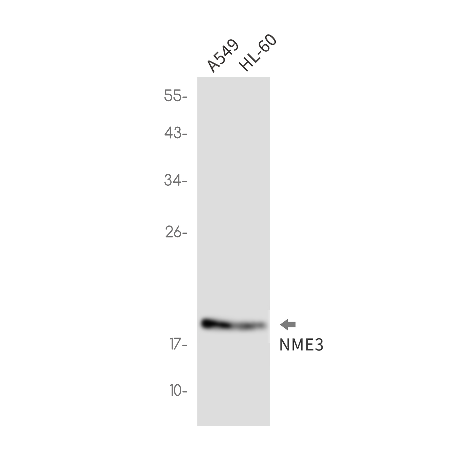 NME3 Rabbit mAb