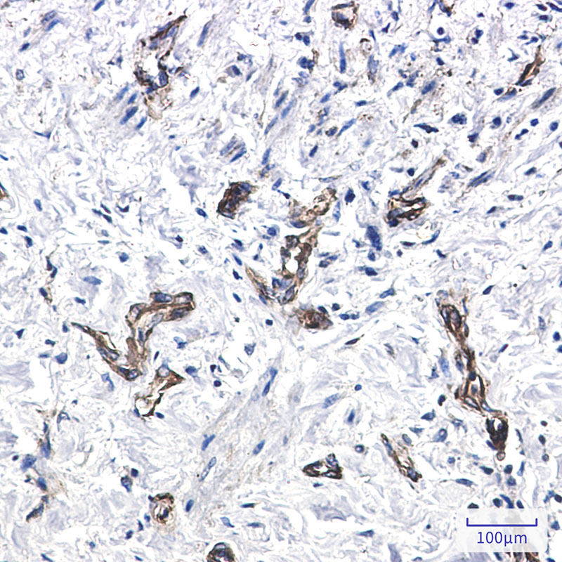 MYH9 Rabbit mAb