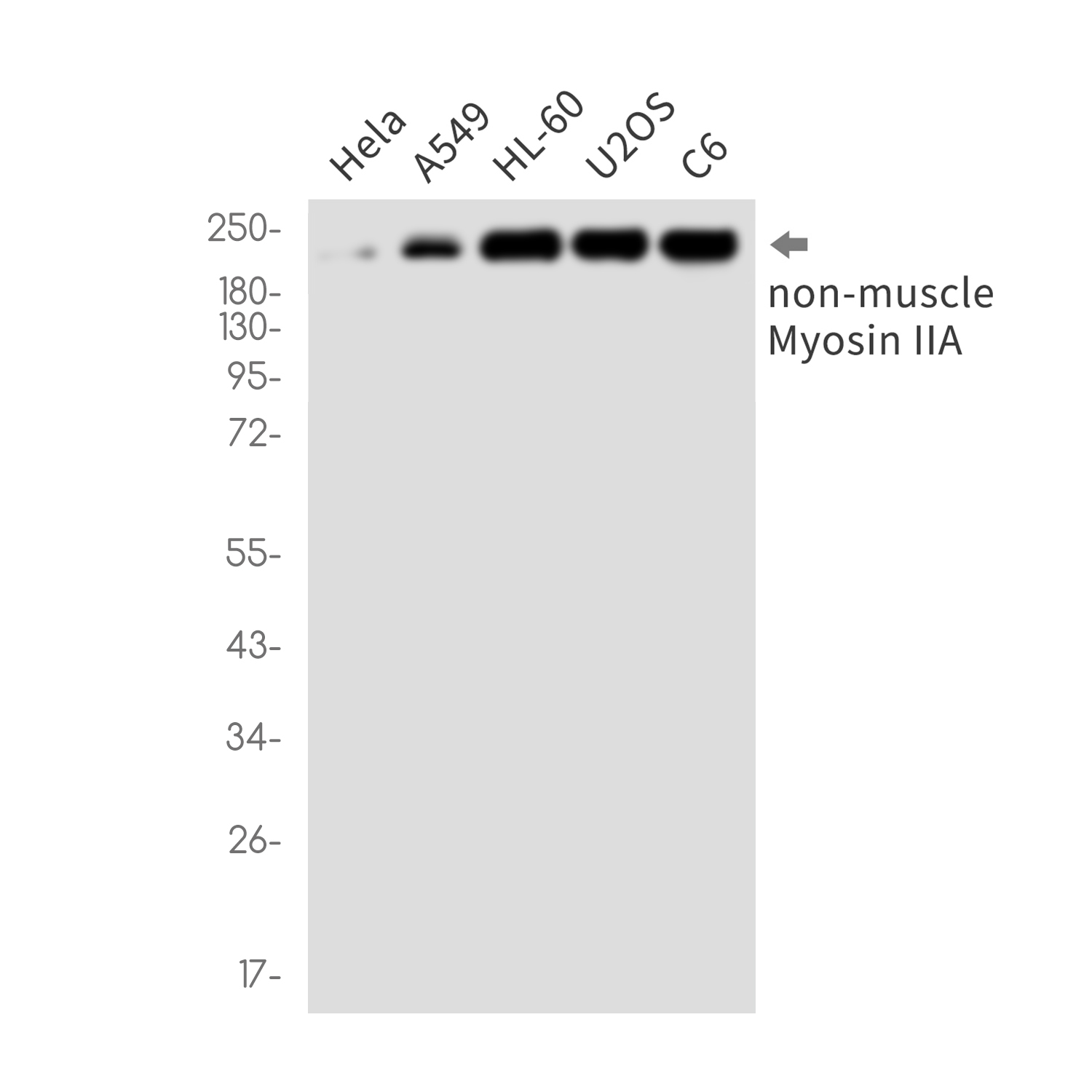 MYH9 Rabbit mAb