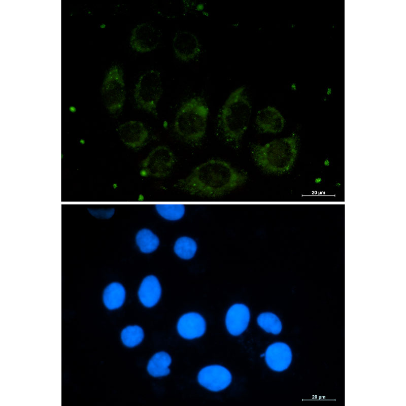 Protein CASP Rabbit mAb