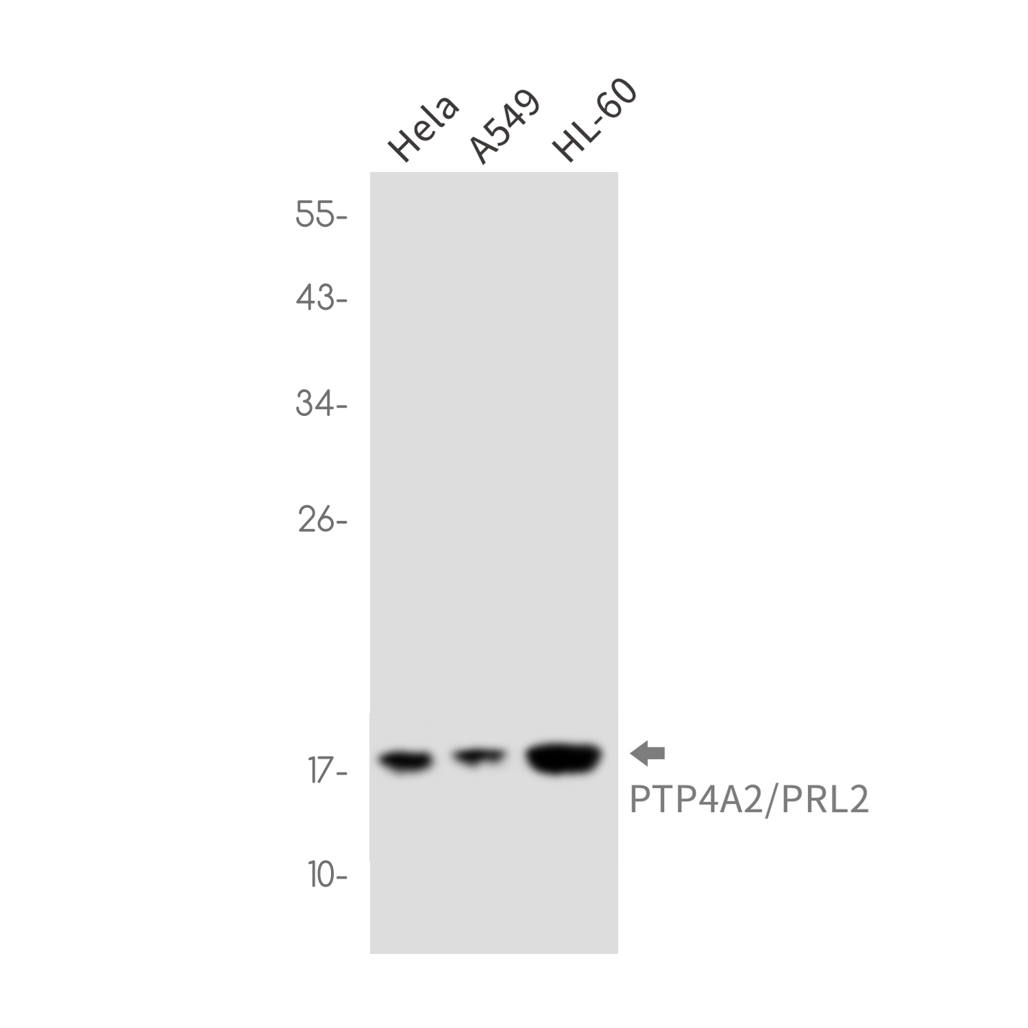 PTP4A2 Rabbit mAb