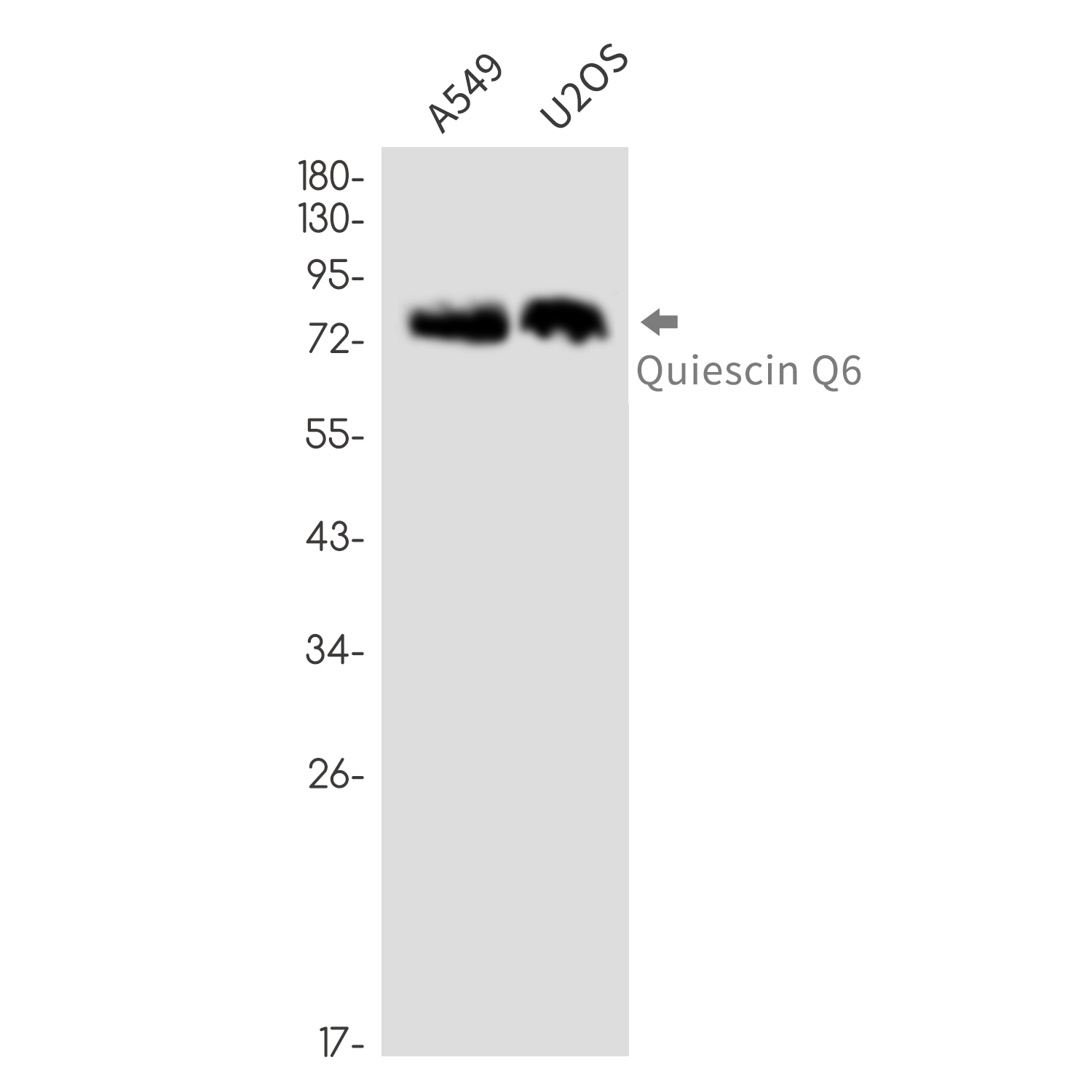 QSOX1 Rabbit mAb