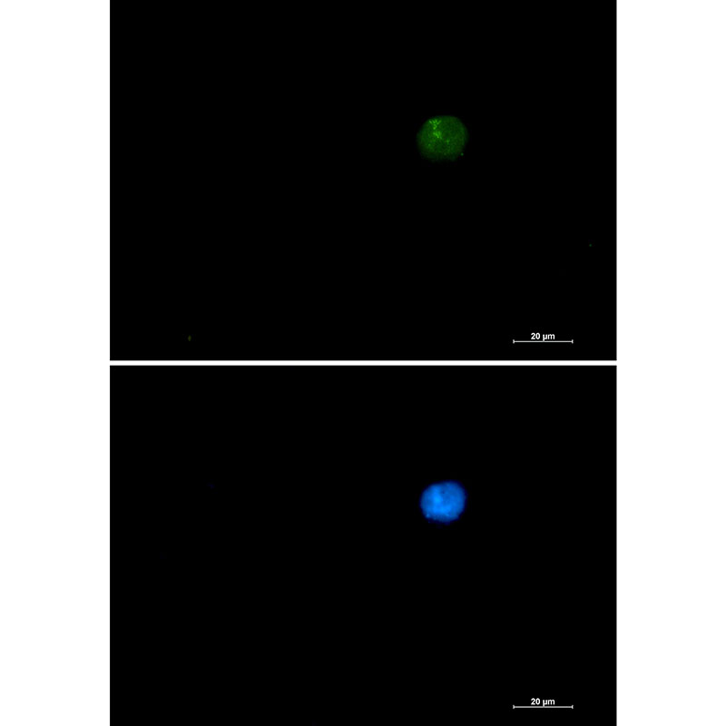 SMARCA2 Rabbit mAb