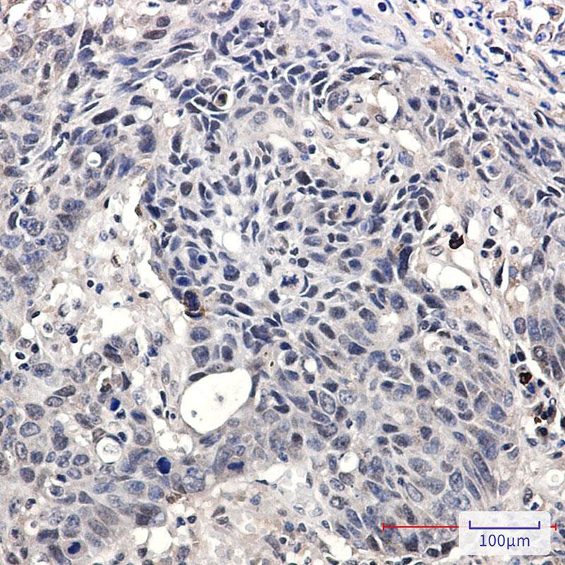 SMARCA2 Rabbit mAb