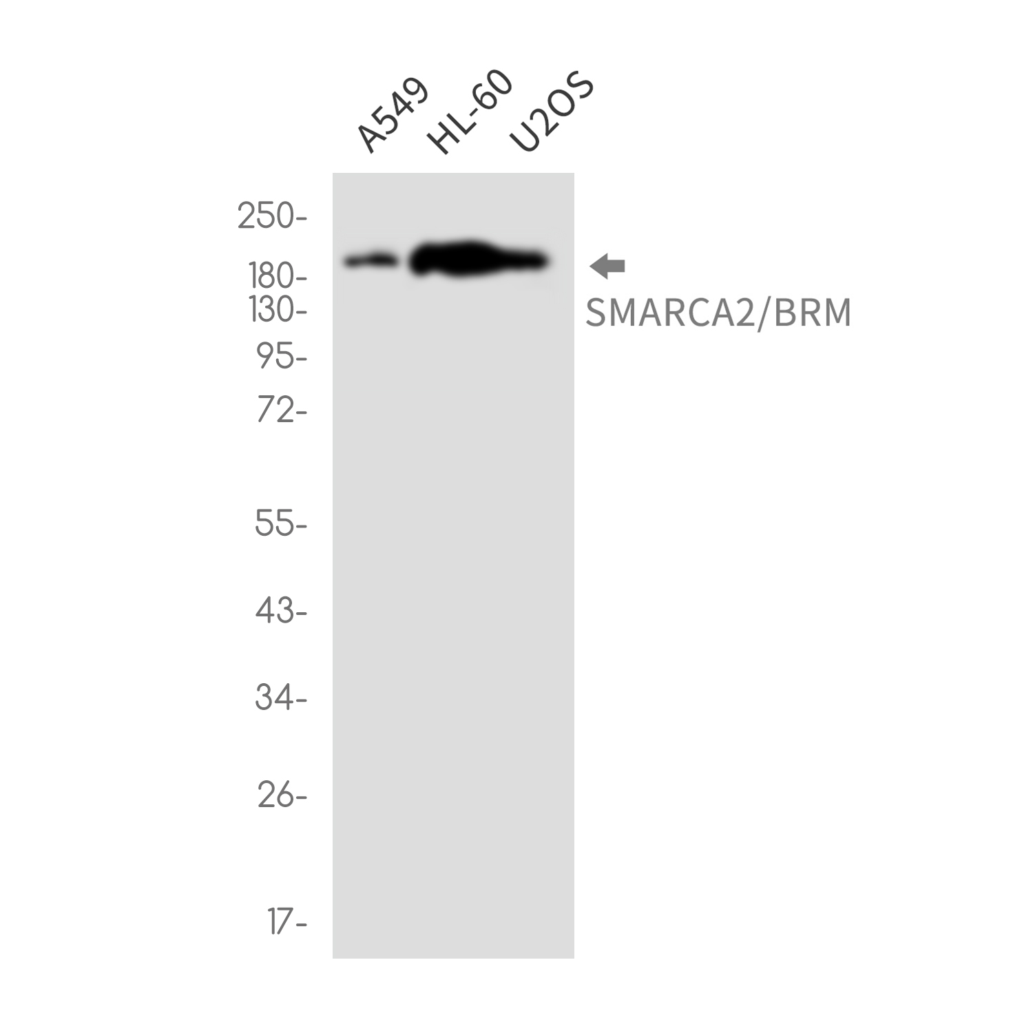 SMARCA2 Rabbit mAb