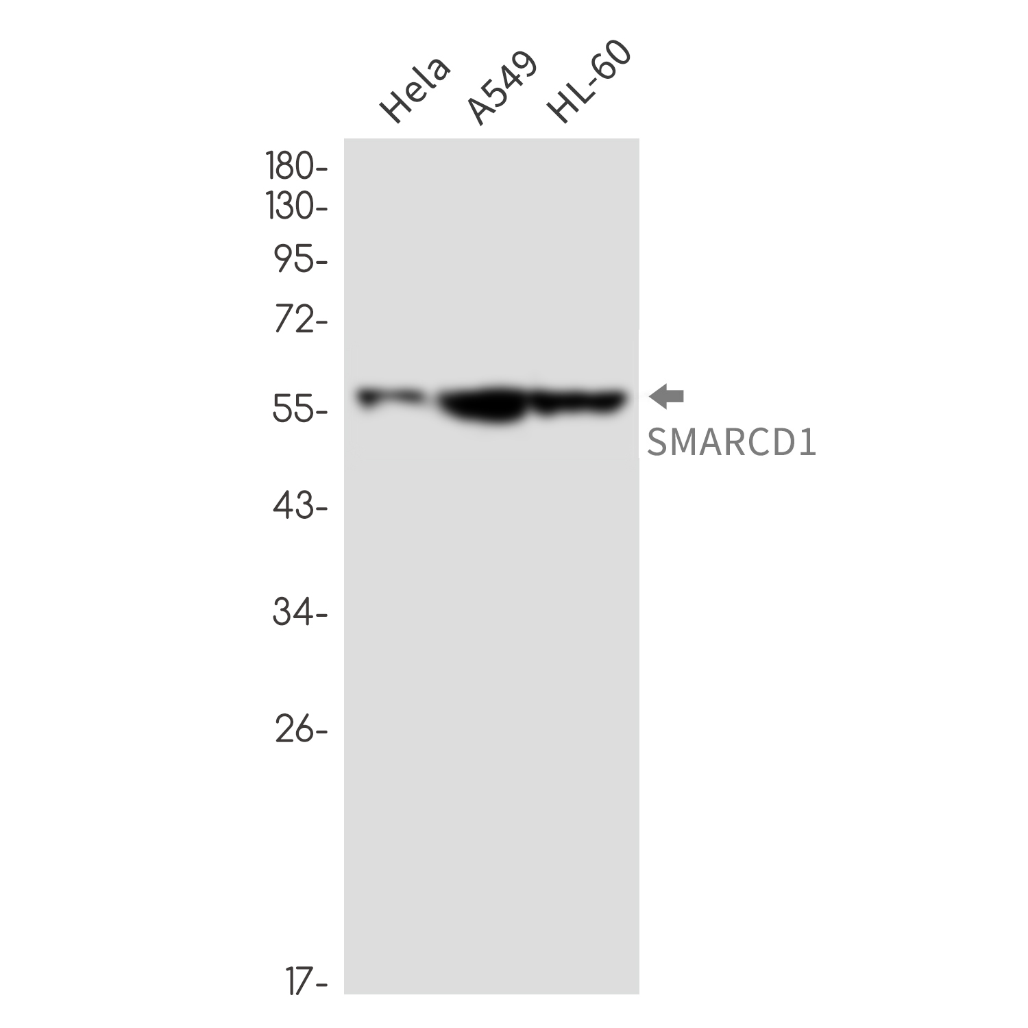 SMARCD1 Rabbit mAb