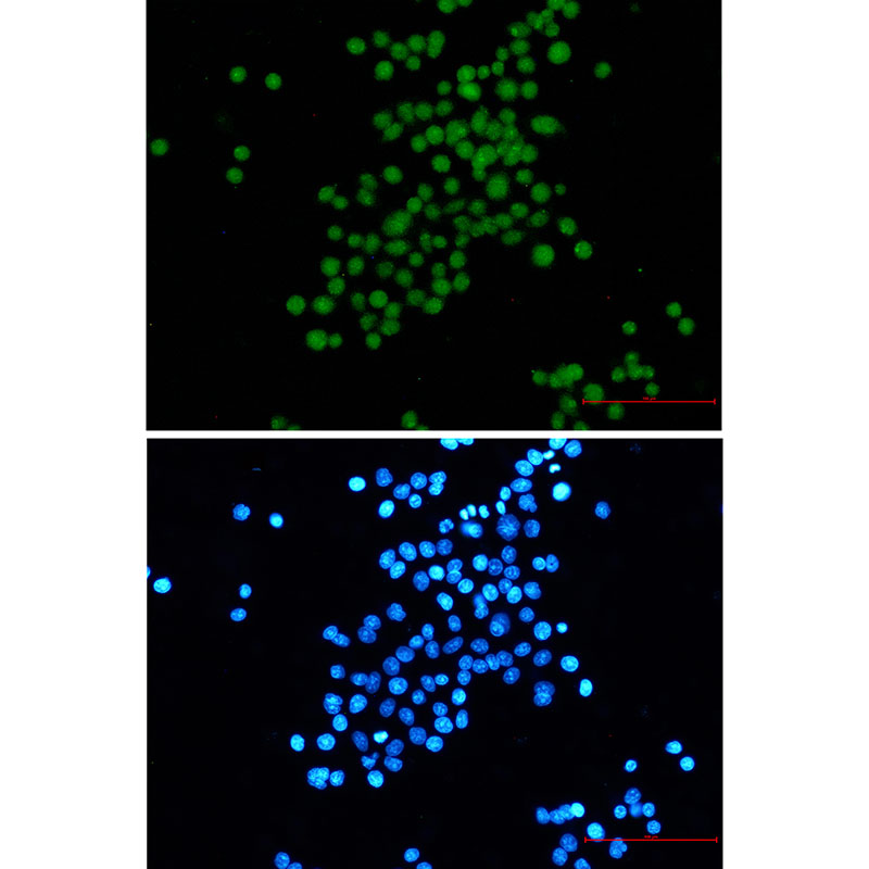 SV40 T Antigen Rabbit mAb