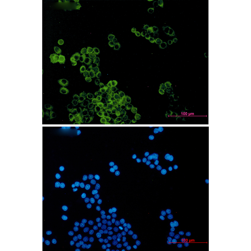 Dynein Light Chain Tctex Type 1 Rabbit mAb