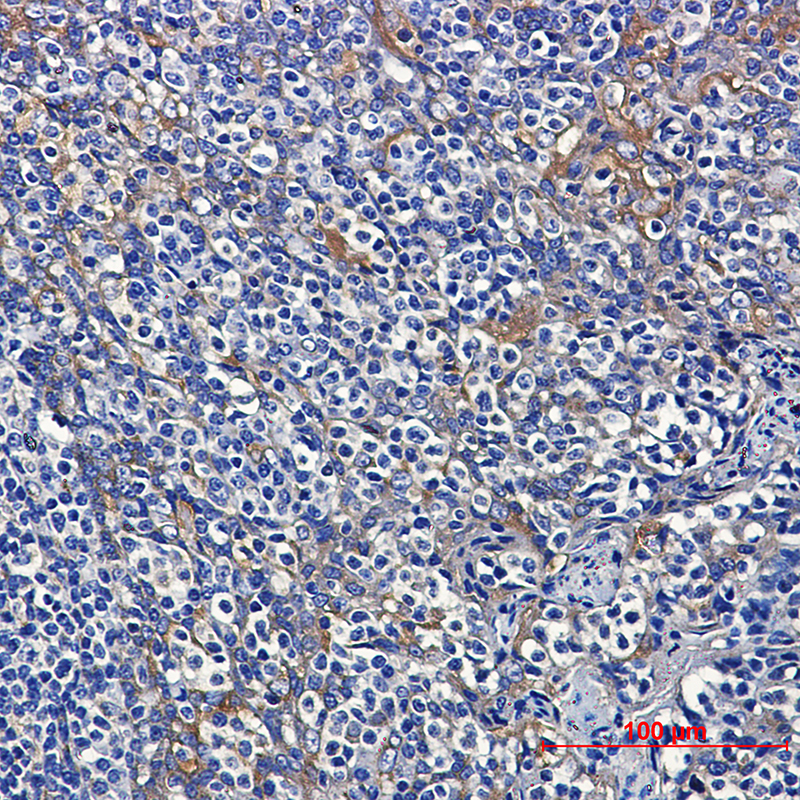 Dynein Light Chain Tctex Type 1 Rabbit mAb