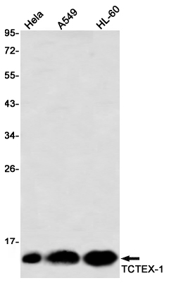 Dynein Light Chain Tctex Type 1 Rabbit mAb