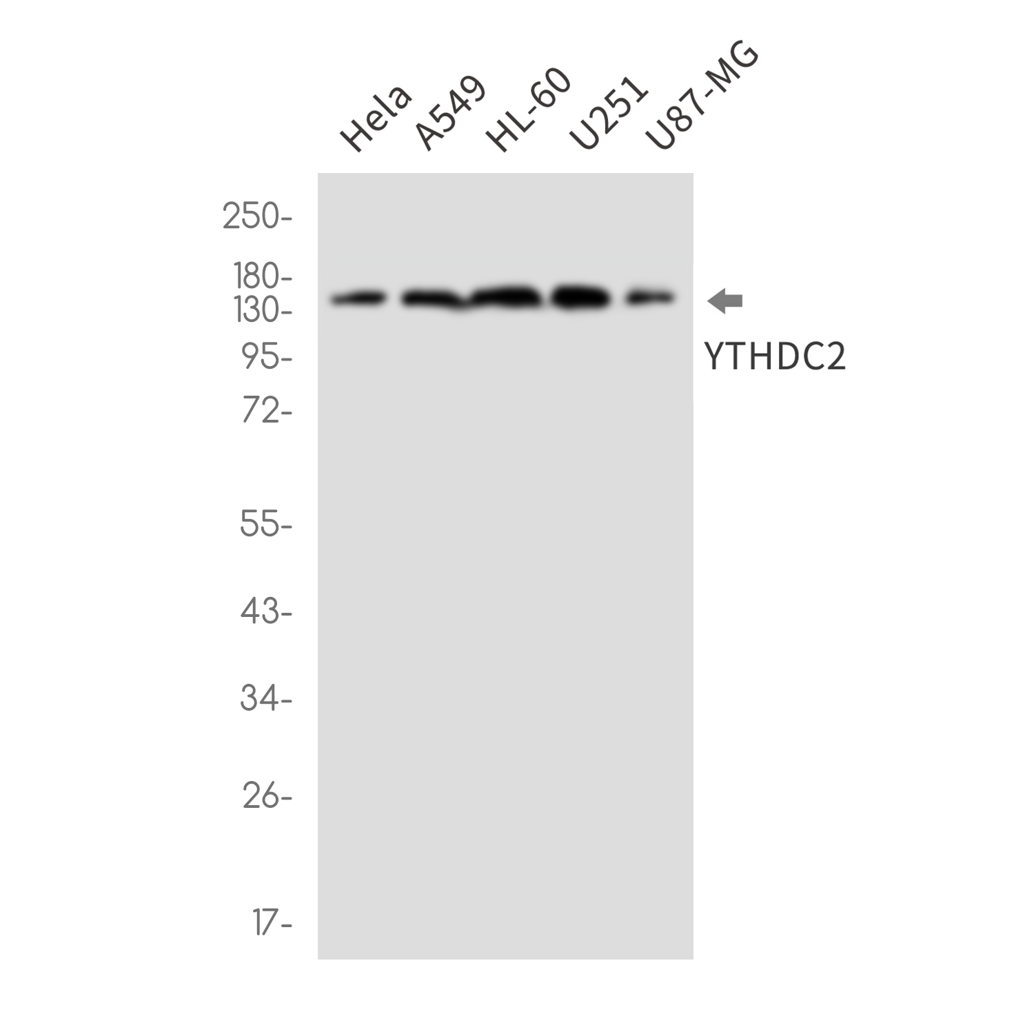 YTHDC2 Rabbit mAb