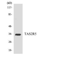 T2R5 Polyclonal Antibody