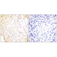 Nkx-3.1 Polyclonal Antibody