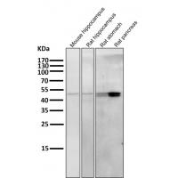 Cytokeratin 20 Antibody