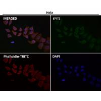 Cytokeratin 20 Antibody