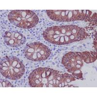 Cytokeratin 20 Antibody