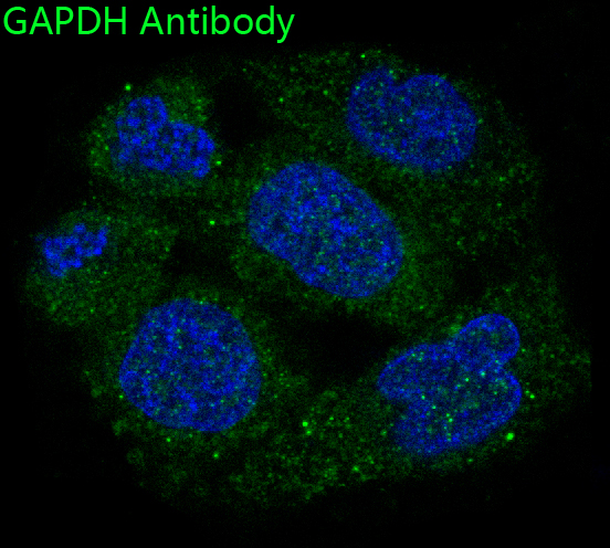 GAPDH Rabbit mAb