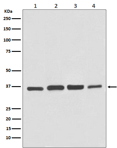 GAPDH Rabbit mAb