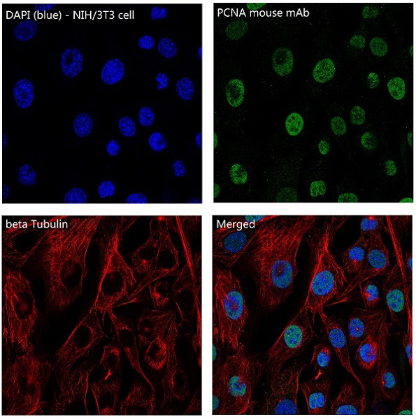 beta Tubulin Rabbit mAb