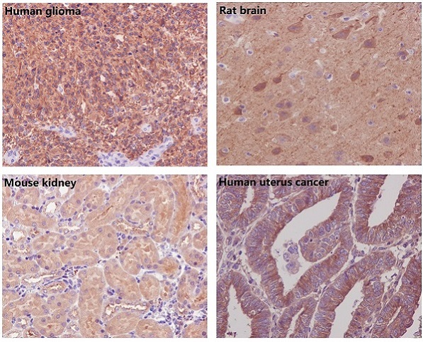 beta Tubulin Rabbit mAb