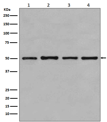 beta Tubulin Rabbit mAb